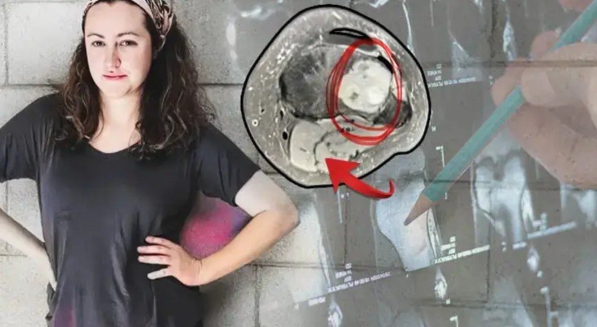 Bacaklarını içten içe yiyip bitirmiş!