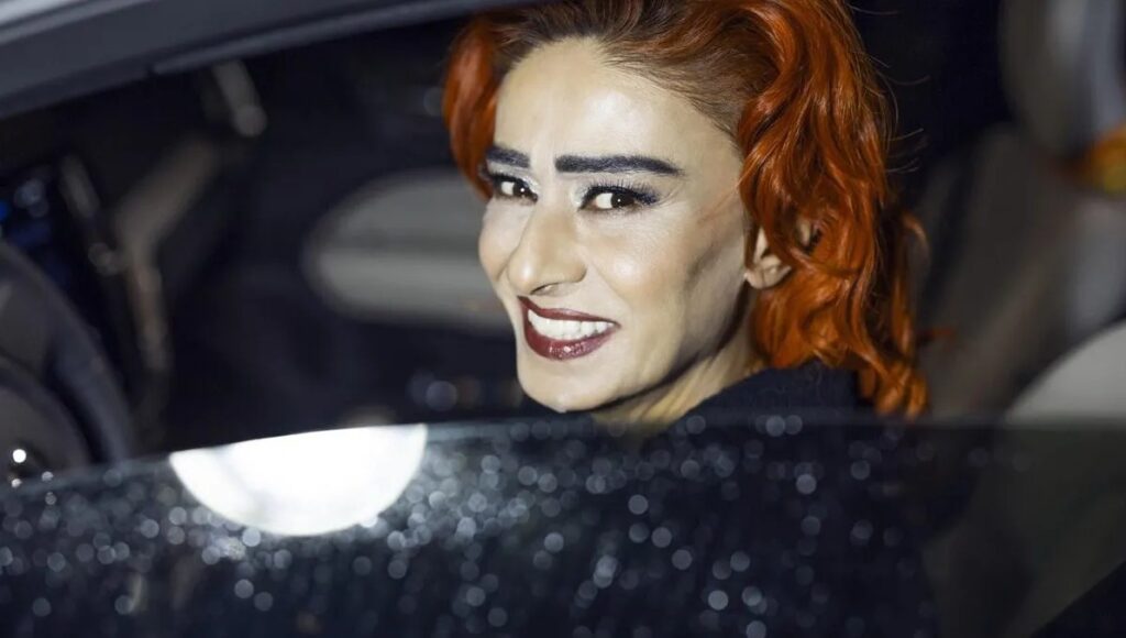 Yıldız Tilbe’nin yüzü yandı
