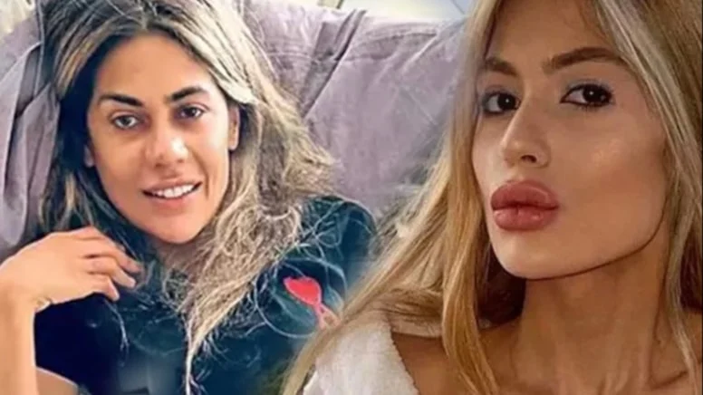 Cezaevinden 37 kilo ile çıkan Nihal Candan’ın son hali gündem oldu