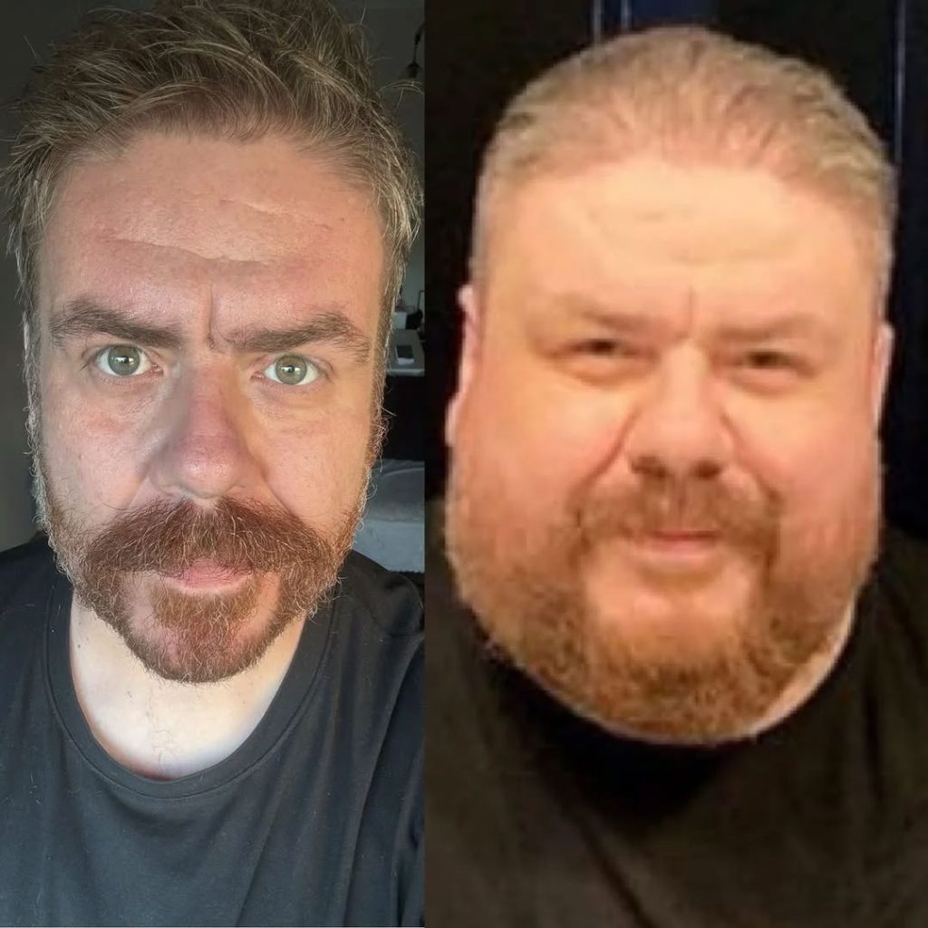 Tam 133 kilo verdi! Ünlü komedyen eski ve yeni halini paylaştı