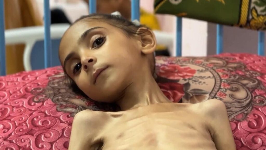 Gazze’de Çocuklar Açlıkla Savaşıyor