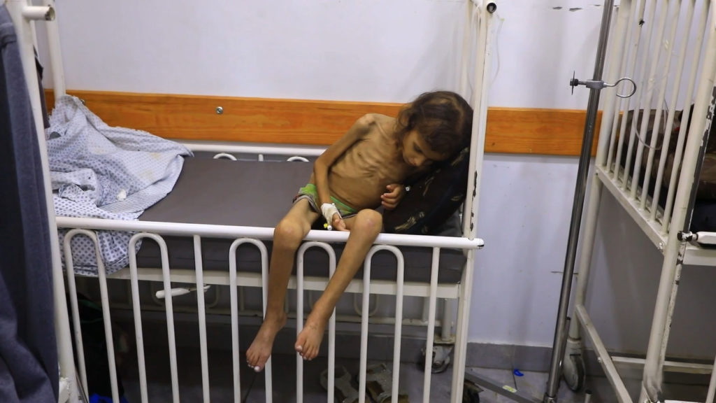 Gazze’de açlık krizi: Çocuklar ölümle pençeleşiyor