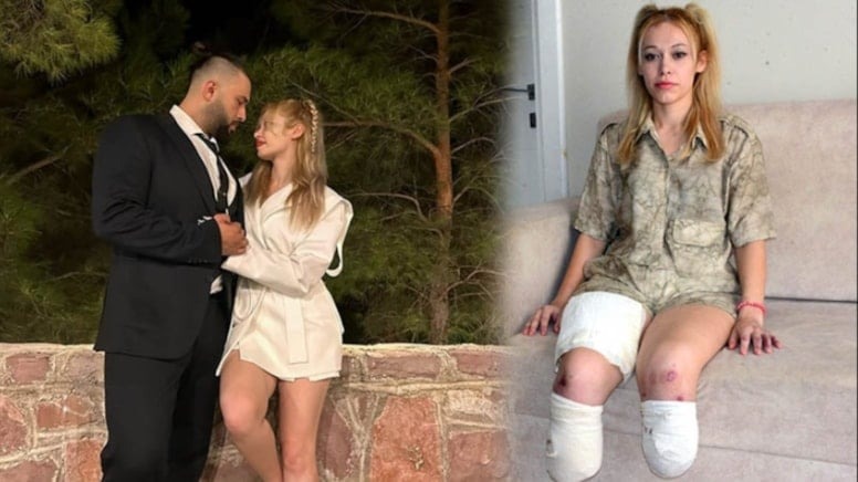 Evlilik yıl dönümünde bacaklarını kaybetti