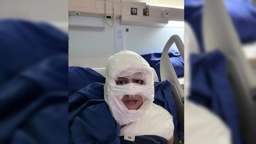 Dehşet veren olay: Kadını yanıcı madde dökerek ateşe verdi