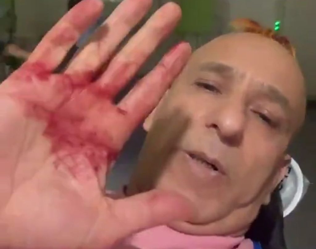 Gurbetçi fenomene Almanya’da silahlı saldırı