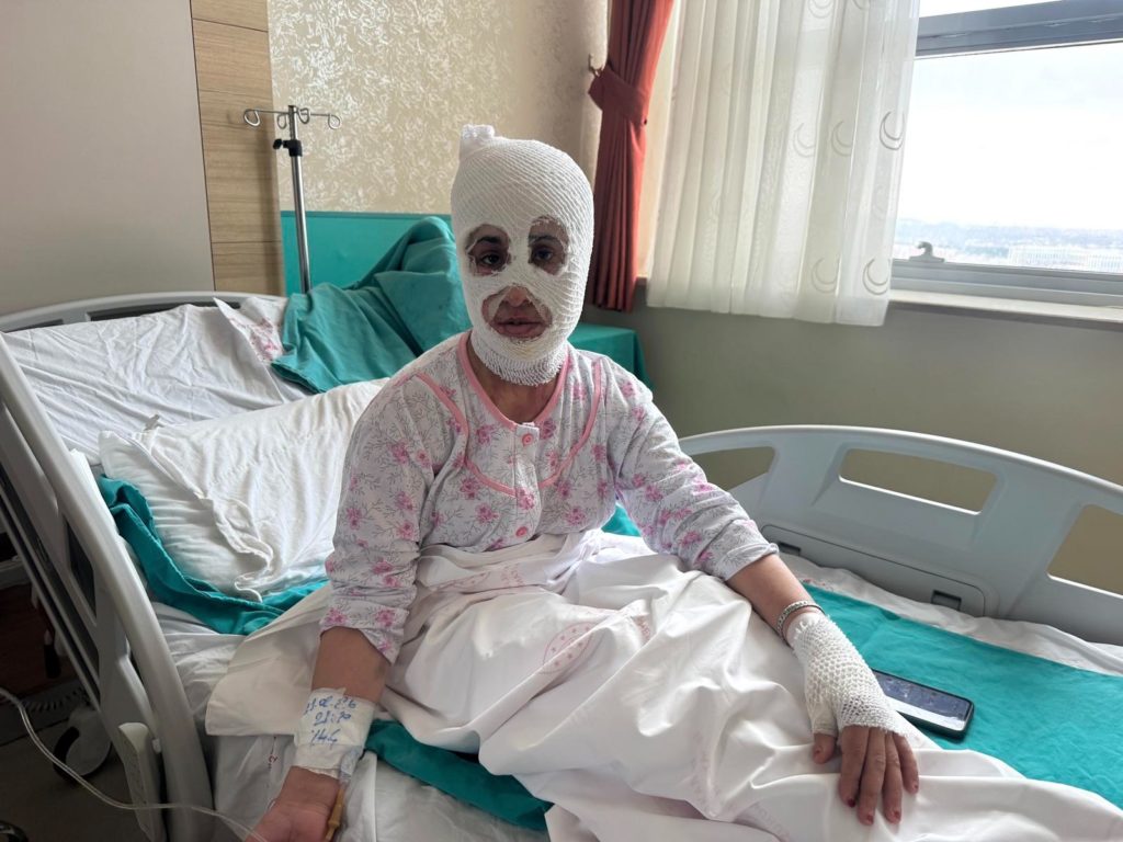 İftar vakti ‘düdüklü tencere’ faciası: Bomba gibi patladı